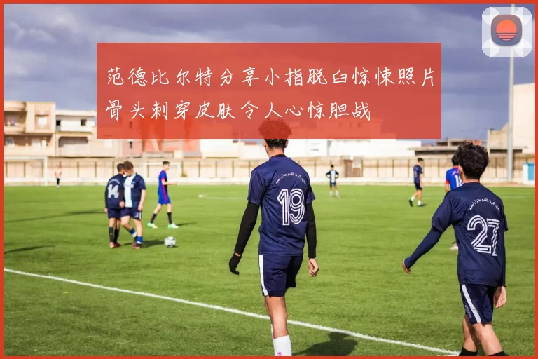 范德比尔特分享小指脱臼惊悚照片骨头刺穿皮肤令人心惊胆战